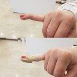کلینیک ارتوپدی فنی نیوان