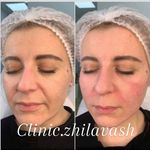 کلینیک پوست و زیبایی ژیلاوَش