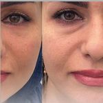 کلینیک پوست و زیبایی ژیلاوَش