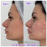 کلینیک پوست،مو،زیبایی و مرکز لیزر نوژا
