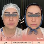 مرکز پزشکی و زیبایی میروژ سنتر