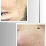 کلینیک فیشیال و پاکسازی پوست صبا