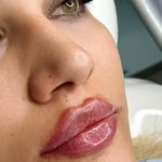 کلینیک زیبایی لیلاک