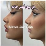 کلینیک زیبایی و مرکز لیزر بارانا