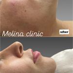 کلینیک تخصصی پوست و زیبایی ملینا
