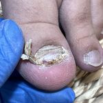 خدمات تخصصی پدیکور و پودولوژی با فروغ