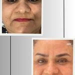 خدمات تخصصی فیشال و پاکسازی پوست صبا