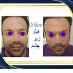 کلینیک پوست مو زیبایی هلیا