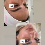 مرکز پاکسازی پوست نازنین کیخانی