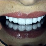 دندانپزشکی دکتر فائزه علی نژاد رودسری