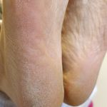 خدمات تخصصی پدیکور مهناز