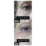 کلینیک پوست مو و زیبایی رکسانا