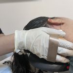 فشیال و اسکراب اسکالپ کلینیک بلا