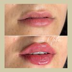 کلینیک زیبایی و لیزر مو زائد نوبا