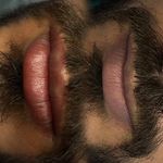 رفع تیرگی لب - اصلاح بدرنگی تتو قدیمی