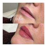 کلینیک زیبایی و لیزر مو زائد نوبا