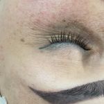 سالن تخصصی پاکسازی پوست هما