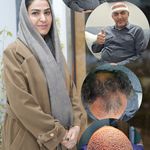کلینیک زیبایی و کاشت مو تخصصی دنسا