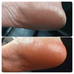 خدمات تخصصی پدیکور درمانی شیوا