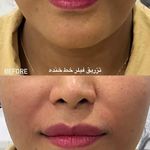 کلینیک لیزر و زیبایی دکتر لیلا حسینی