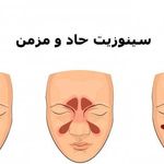 مشاور طب سوزنی و سنتی
