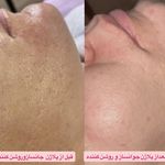 مرکز لیزر موهای زائد ماهور