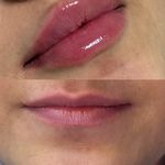 مرکز پوست و لیزر  سایناشور آمریکا دلدار