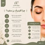 مرکز بلفاروپلاستی فوق تخصصی رز سفید