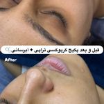 مژگان اسکین کرMojgan skincare