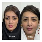 کلینیک پوست،مو وزیبایی مانلی(دکتر دهقان)