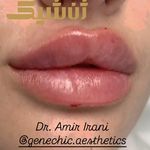 مطب پوست مو زیبایی و لاغری ژن شیک