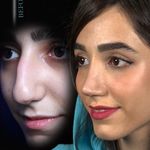 کلینیک جراحی بینی مینی bini mini