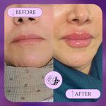 کلینیک زیبایی و مرکز لیزر ماهورا