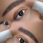 خدمات تخصصی فیبروز تینا درخشان