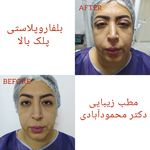 مركز ليزر و مطب زيبايی دكتر محمودآبادی