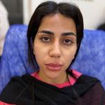 کلینیک تخصصی ژل و بوتاکس مرضیه آقابابایی