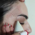 کلینیک زیبایی پوست مو لاغری موضعی لیلاک