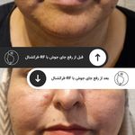 مرکز لیرز و جوانسازی پوست شهربانو
