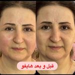 کلینیک لیزر و  زیبایی ملیح