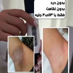 مرکز لیزر و پاکسازی پوست سحر