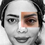 کلینیک لیزر وزیبایی درتا