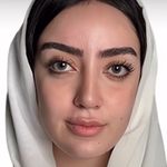 کلینیک زیبایی الماس کاملا اقساطی