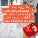 خدمات تخصصی فیشال و اسکالپ سر