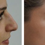 کلینیک زیبایی الماس کاملا اقساطی