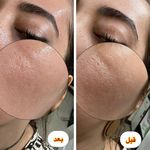 فیشال و خدمات پاکسازی پوست  فاطمه انامی