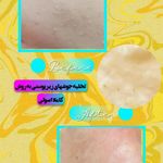 فیشیال و پاکسازی پوست مریم