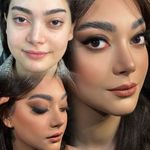 کاشت و ترمیم ناخن