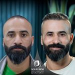 کلینیک پوست مو و زیبایی نوین ایرانا