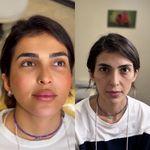 مطب دکتر زمانی رافع