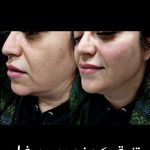 مرکزکلینیک لیزر زیبایی پوست و مو آسا